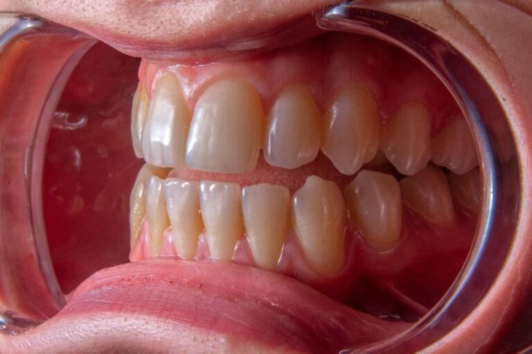 Open mouth with teeth