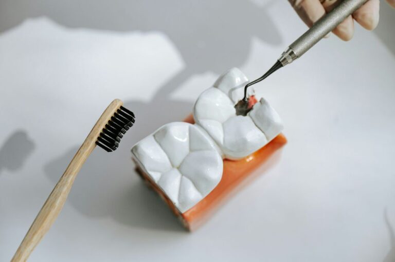 Model of tooth fillings