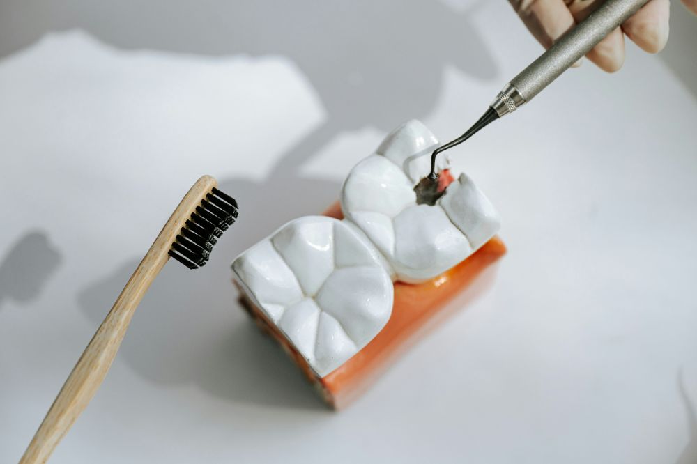Model of tooth fillings