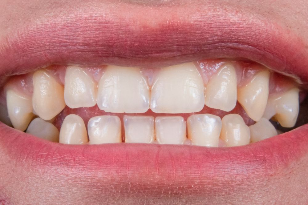 Person smiling